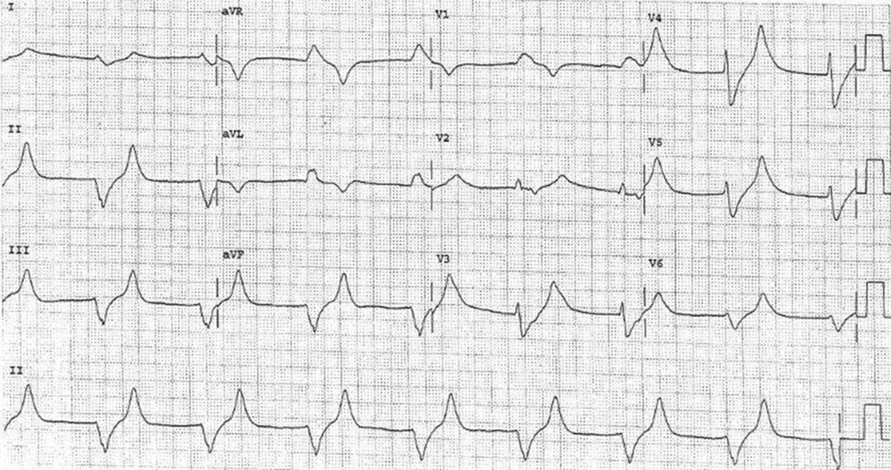 問題No.4