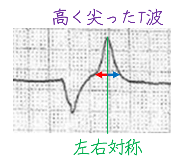 問題No.4