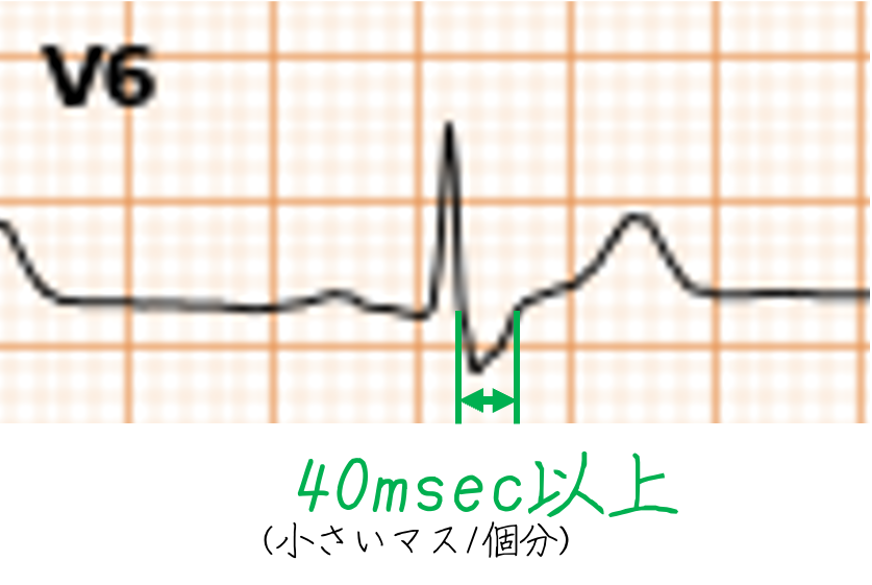 問題No.11