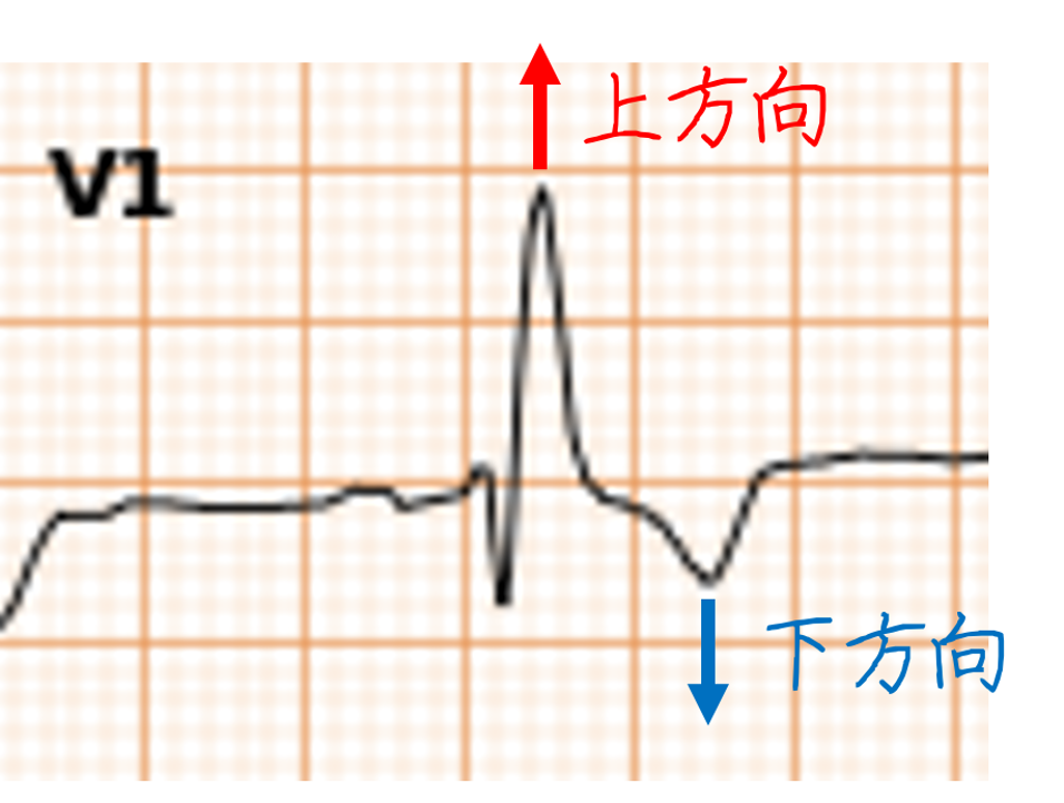問題No.11