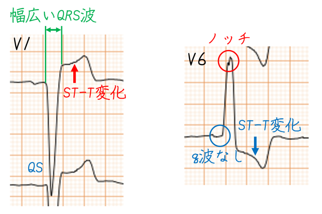 問題No.14